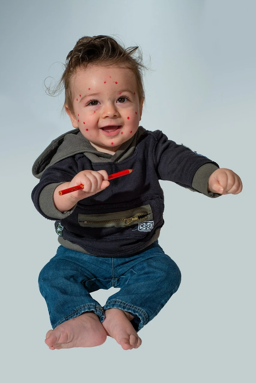 La Varicelle chez l’Enfant, La varicelle est une maladie infectieuse courante chez les enfants www.ecoledesecours.ch 079-535-13-71