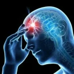 Différence entre céphalées et migraines, maux de tête courants qui touchent des millions de personnes .www.ecoledesecours.ch 079-535-13-71