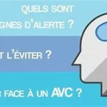 AVC une urgence Vitale, cours de 1er secours assurés par des professionnels de la santé uniquement, www.ecoledesecours.ch 079-535-13-71