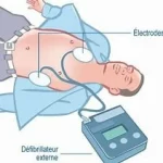 BLS AED SRC Territet FPH, ASCA, first responders, garde bain, samaritains permis conduire www.ecoledesecours.ch 079-535-13-71