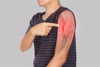 Comprendre la déchirure musculaire, appelée claquage, est une lésion fréquente www.ecoledesecours.ch 079-535-13-71