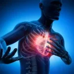Facteurs risque maladies cardiovasculaires, principales causes de décès dans le monde cours BLS AED SRC www.ecoledesecours.ch 079-535-13-71