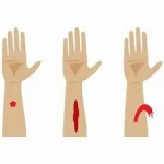 Causes de traumatismes dentaires, blessure fréquente des dents, gencives et les structures environnantes.www.ecoledesecours.ch 079-535-13-71
