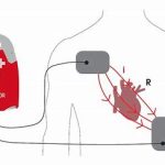 formation BLS AED Roche FPH, ASCA, first responders, garde bain, samaritains permis conduire www.ecoledesecours.ch 079-535-13-71