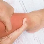 Dangers de la Phlébite, aussi appelée thrombose veineuse, est une affection sérieuse. .www.ecoledesecours.ch 079-535-13-71