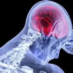 Signes et symptômes AVC, Un accident vasculaire cérébral (AVC) est une urgence médicale . ww.ecoledesecours.ch 079-535-13-71