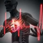 Comment éviter un infarctus, appelé crise cardiaque, une des principales causes de mortalité dans le monde. ww.ecoledesecours.ch 079-535-13-71