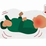 Différencier Epilepsie et convulsion fébrile, Convulsion fébrile et crise d’épilepsie chez l’enfant : www.ecoledesecours.ch 079-535-13-71