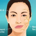 Paralysie faciale que faire ? se manifeste par une perte soudaine de la mobilité d’un côté du visage www.ecoledesecours.ch 079-535-13-71