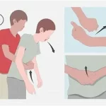 Inhalation corps étranger que faire? un objet solide ou une particule pénètre dans les voies respiratoires www.ecoledesecours.ch 079-535-13-71