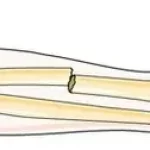 Fracture fermée que faire ? Une fracture fermée est une cassure d’un os sans ouverture visible de la peau. www.ecoledesecours.ch