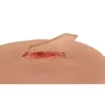 Blessures par corps étrangers que faire ? (écharde, morceau de verre, métal, gravier, etc.) peut survenir à tout moment www.ecoledesecours.ch