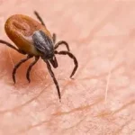 Piqûre tique que faire ? petits acariens qui se nourrissent de sang et peuvent transmettre des maladies graves. www.ecoledesecours.ch