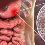 Hémorragie digestive que faire ? perte de sang dans le tube digestif, depuis l’œsophage jusqu’au rectum. 079-535-13-71 www.ecoledesecours.ch
