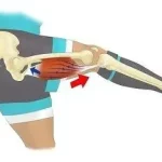 Claquage musculaire que faire ? blessure fréquente chez les sportifs ou mouvement brusque du quotidien. 079-535-13-71 www.ecoledesecours.ch