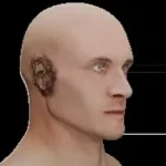 Traumatisme de l'oreille que faire ? choc ,exposition à un bruit ,objet dans le conduit auditif. 079-535-13-71 www.ecoledesecours.ch