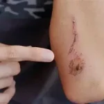 Défaut de cicatrisation que faire ? une plaie qui tarde à se refermer, s’infecte 079-535-13-71 www.ecoledesecours.ch