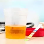 Sang dans les urines que faire ? aussi appelée hématurie, est un symptôme qui peut inquiéter 079-535-13-71 www.ecoledesecours.ch