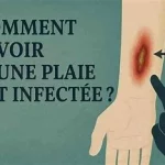 Plaie infectée que faire ? éviter les complications et favoriser une bonne cicatrisation. 079-535-13-71 www.ecoledesecours.ch