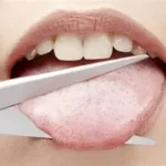 Langue sectionnée que faire ? blessure grave, impressionnante qui nécessite une réaction rapide et adaptée.www.ecoledesecours.ch 079-535-13-71