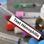 Hémophile et conduite à tenir ? une maladie génétique rare qui affecte la coagulation du sang ecoledesecours.ch 079-535-13-71