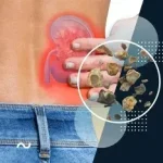 Calculs rénaux que faire ? aussi appelés lithiases urinaires, touchent chaque année de nombreuses personnes ecoledesecours.ch 079-535-13-71
